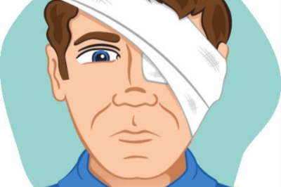 眼外伤造成的散光