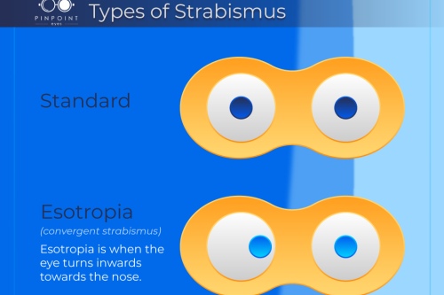 一张图测试自己是否斜视！带你了解斜视对视功能的影响有多大？