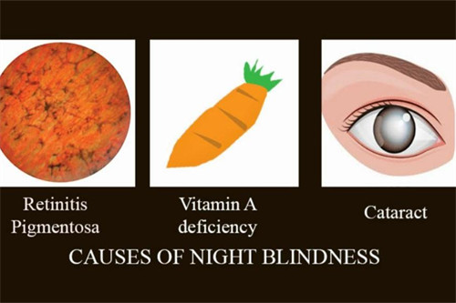 夜盲症诱因示意图 夜盲症诱因示意图