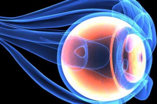 玻璃体浑浊示意图