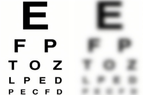 深挖：弱视形成的主要原因及其治疗方法！这篇问答全都有！