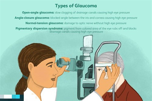 青光眼检查动画示意图