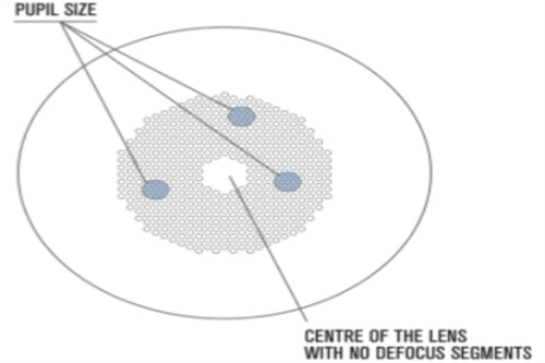离焦眼镜示意图