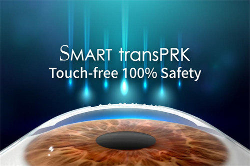 smart全激光手术动画示意图