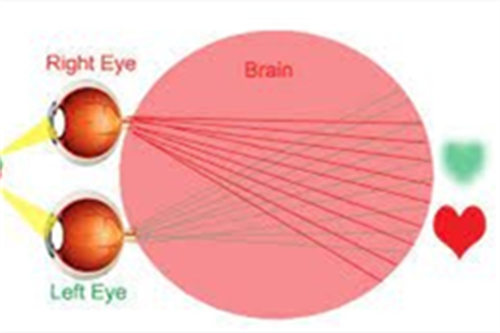 弱视视网膜聚焦