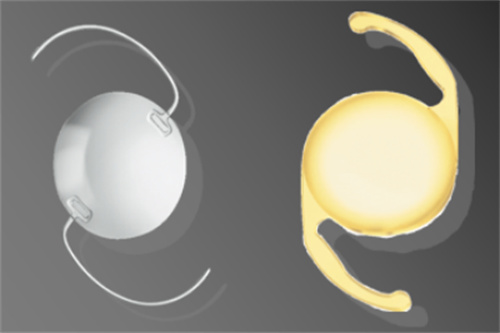 负球差人工晶体