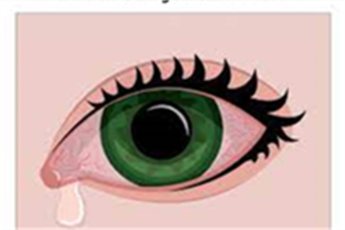 深度了解角膜炎和结膜炎：它们不一样/症状和区别解析