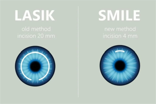 哈尔滨眼科医生排名：王霁雪/孙永欣/岳以英/于永斌/张长弓/车红医生都是其中的佼佼者！