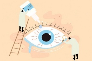 白内障眼睛示意图_副本