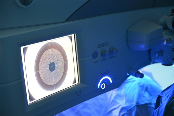 近视眼治疗图 近视眼治疗图