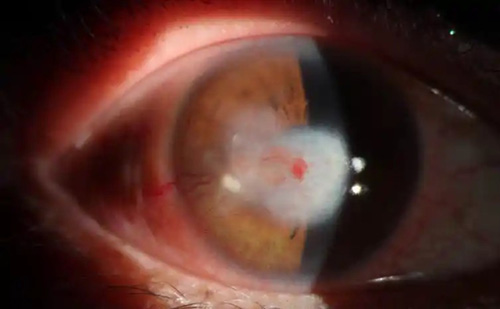 u=831994117,3116152348&fm=253&fmt=auto&app=120&f=JPEG u=831994117,3116152348&fm=253&fmt=auto&app=120&f=JPEG