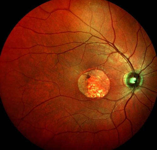 v2-9328c2aeb3f27a20a52eb46c56b260b9_r v2-9328c2aeb3f27a20a52eb46c56b260b9_r