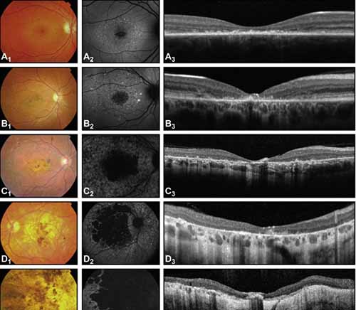 v2-9b505b62d97fd7e4d0ec4dada746a172_r v2-9b505b62d97fd7e4d0ec4dada746a172_r