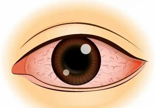 u=921871800,2911469686&fm=253&fmt=auto&app=138&f=JPEG u=921871800,2911469686&fm=253&fmt=auto&app=138&f=JPEG