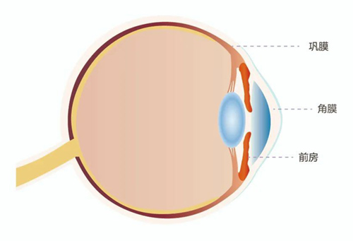 角膜炎有哪些症状？看看你中招没，如何预防角膜炎？