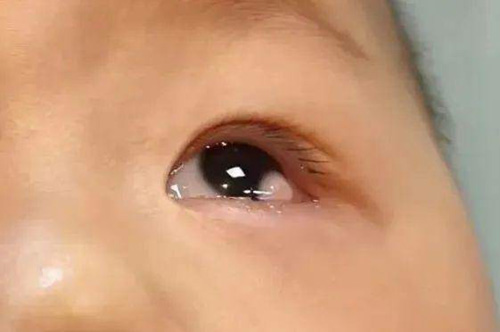 79d85b3f7a1d44a2baf8f3615bd91237 79d85b3f7a1d44a2baf8f3615bd91237