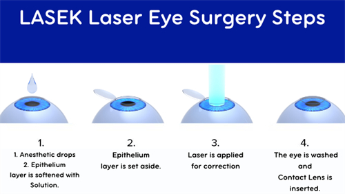 近视手术流程图 近视手术流程图