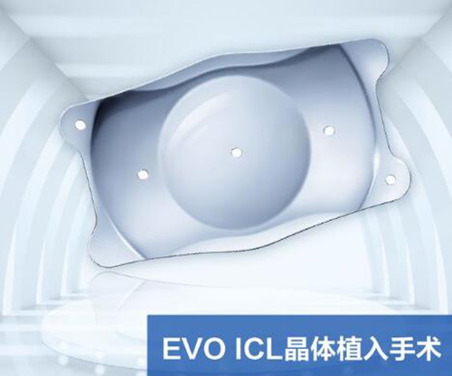 重庆新视界渝中眼科晶体植入