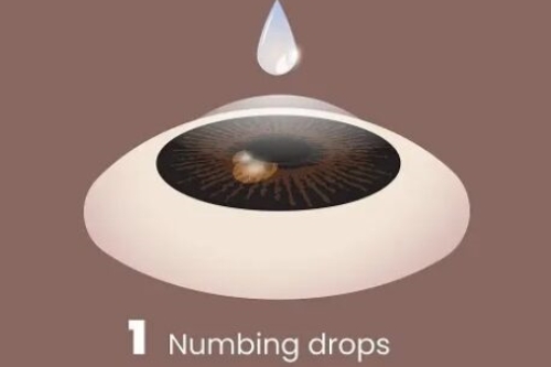 2025年3月郑州洛阳新乡南阳近视矫正/散光/远视/屈光不正/眼表疾病价格表 