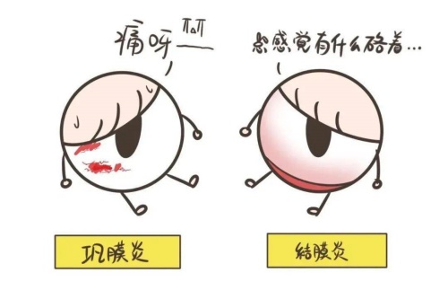 巩膜炎与结膜炎卡通对比图 巩膜炎与结膜炎卡通对比图