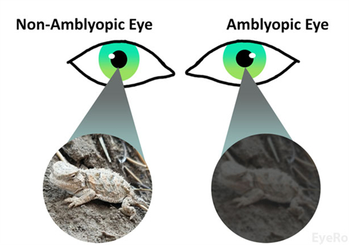 2025年3月中山珠海惠州江门近视矫正/散光/远视/屈光不正/眼表疾病价格表 