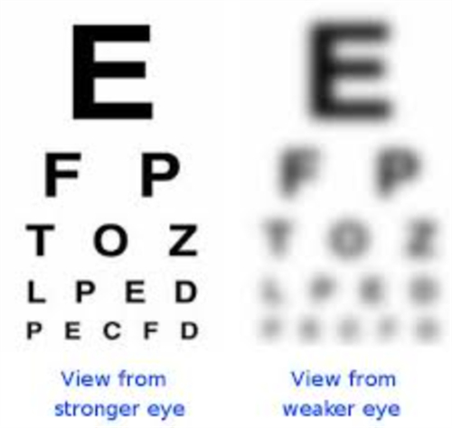 2025年3月汕头湛江肇庆茂名近视矫正/散光/远视/屈光不正/眼表疾病价格表 