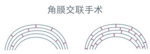 2025年3月双鸭山鹤岗黑河伊春七台河大兴安岭近视矫正/散光/远视/屈光不正/眼表疾病价格表 
