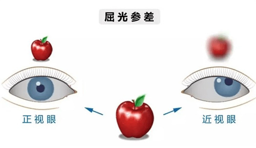 飞秒激光近视手术医师周跃华医生，为什么这么多人找他？