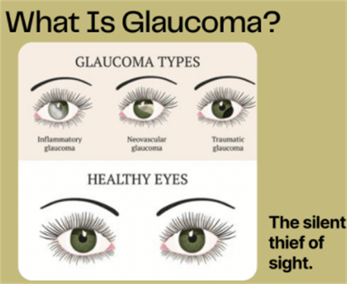 青光眼相关问题50问，快来一文看完所有青光眼问题！
