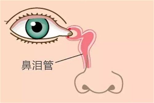泪道阻塞30个常见问题！这是你的泪道阻塞知识盲区吗？