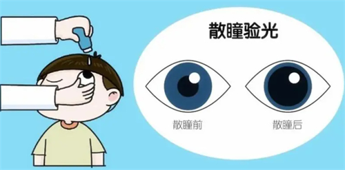 散瞳验光过程图解 散瞳验光过程图解