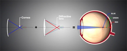 晶体植入前后 晶体植入前后