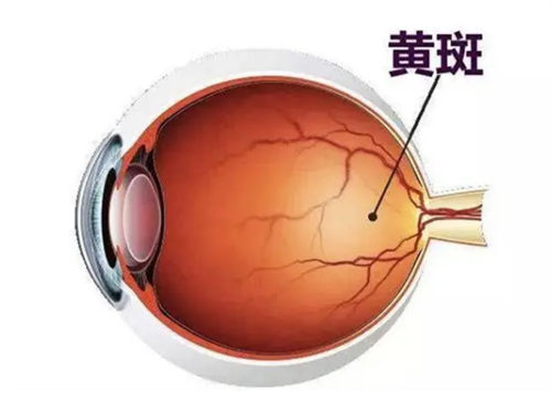 黄斑病变手术可以报销吗？最新医保政策解析