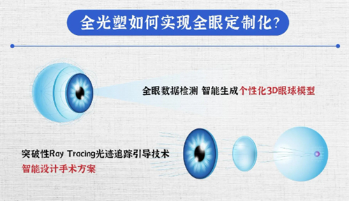 全光塑手术过程介绍